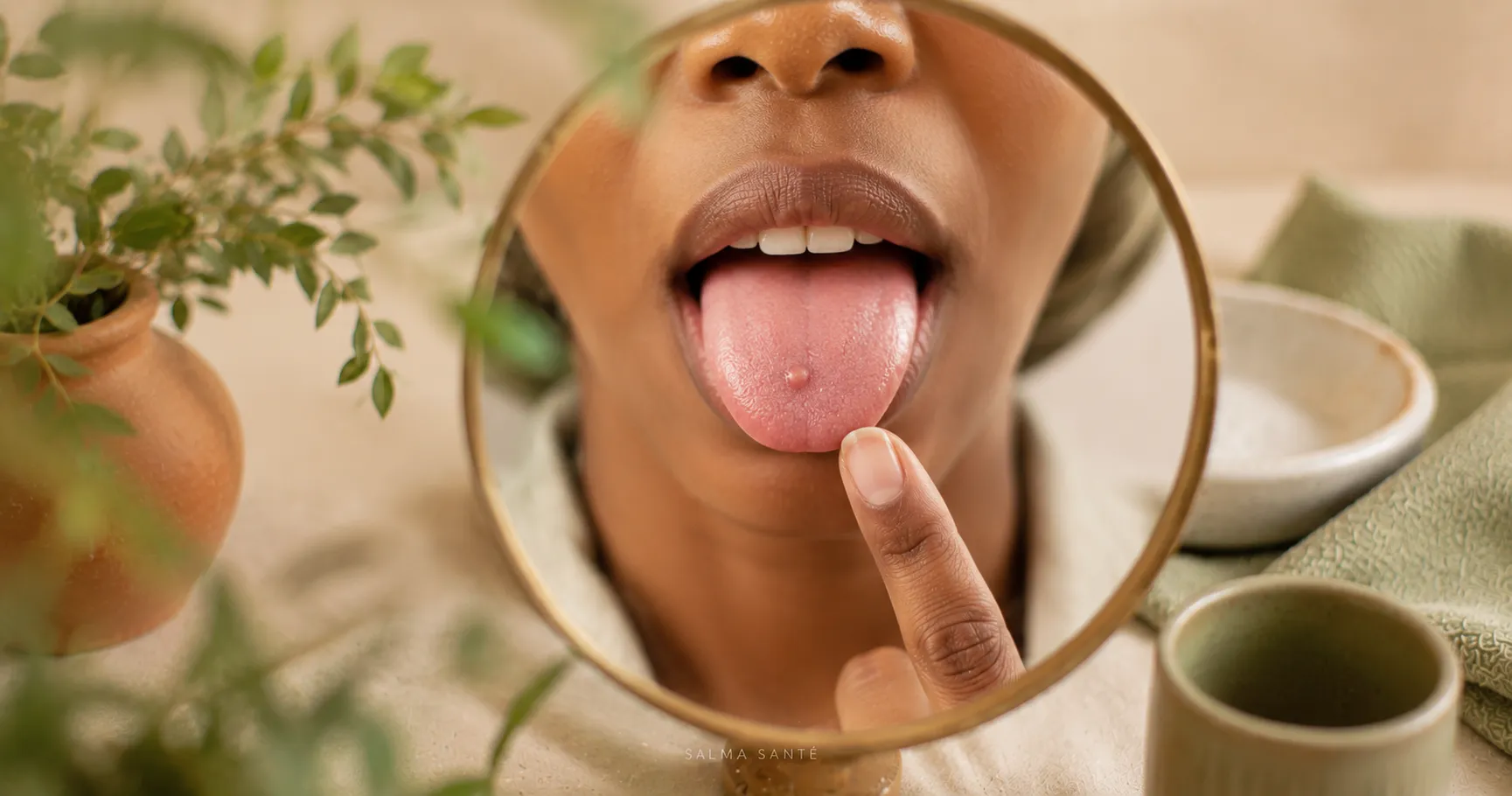 bouton sur la langue salma sante